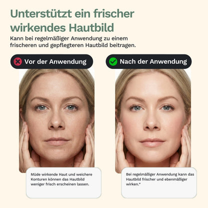 Rolandus G1 - přístroj na masáž obličeje