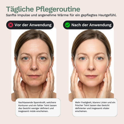 Rolandus G1 Pro - Gesichtsmassagegerät